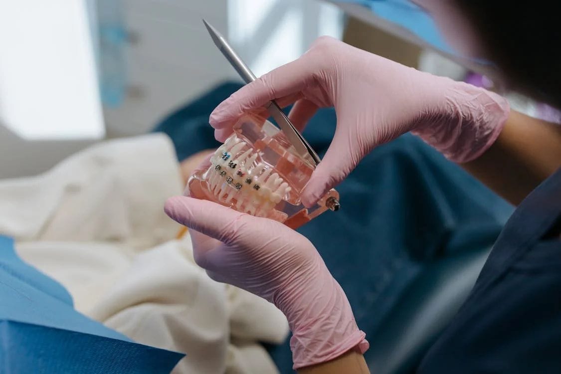 Aparat Dentar Ploiești – Soluția Perfectă pentru un Zâmbet Sănătos și Aliniat 🦷✨ 2 Aparat Dentar Ploiesti